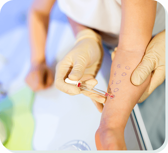What is a skin prick test?